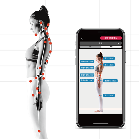 姿勢・歩行AI分析アプリが高齢者も処方可能に
